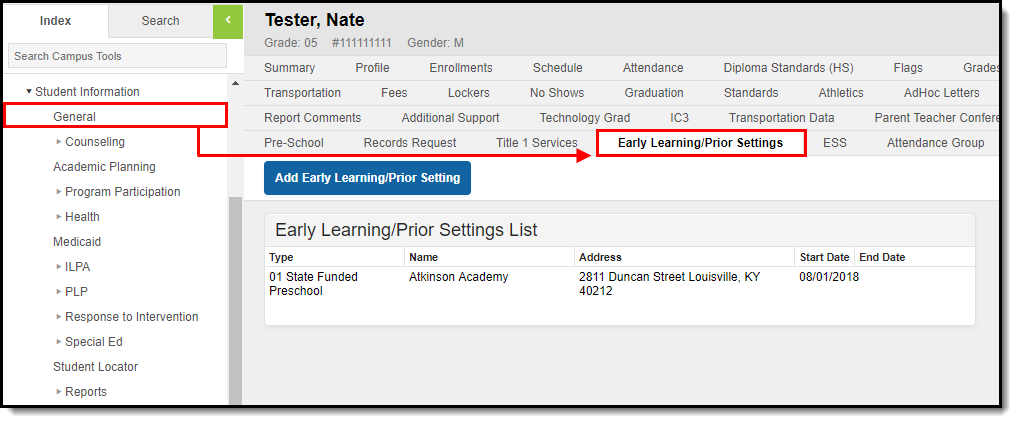 Screenshot displaying the Early Learning/Prior Settings tab displaying its location within the Index.