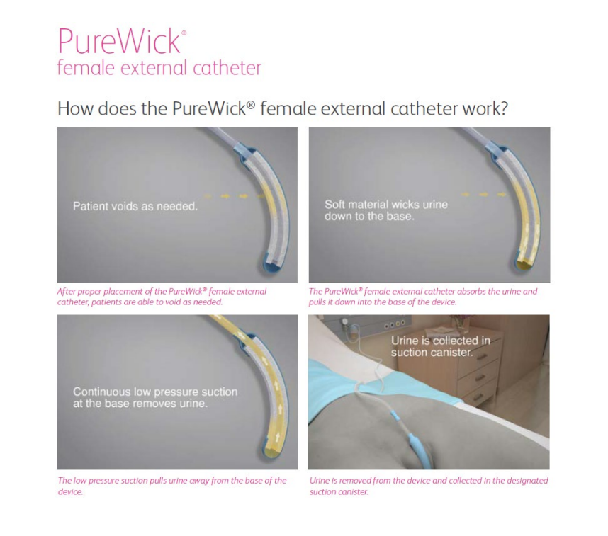 HHA Competency - External Female Catheter (Purewick) | Recover Care