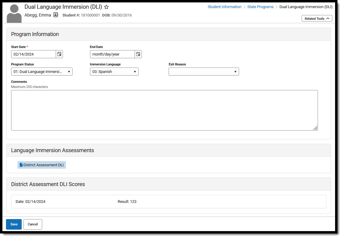 Screenshot of Dual Language Immersion Program Information editor with available fields including assessment data.