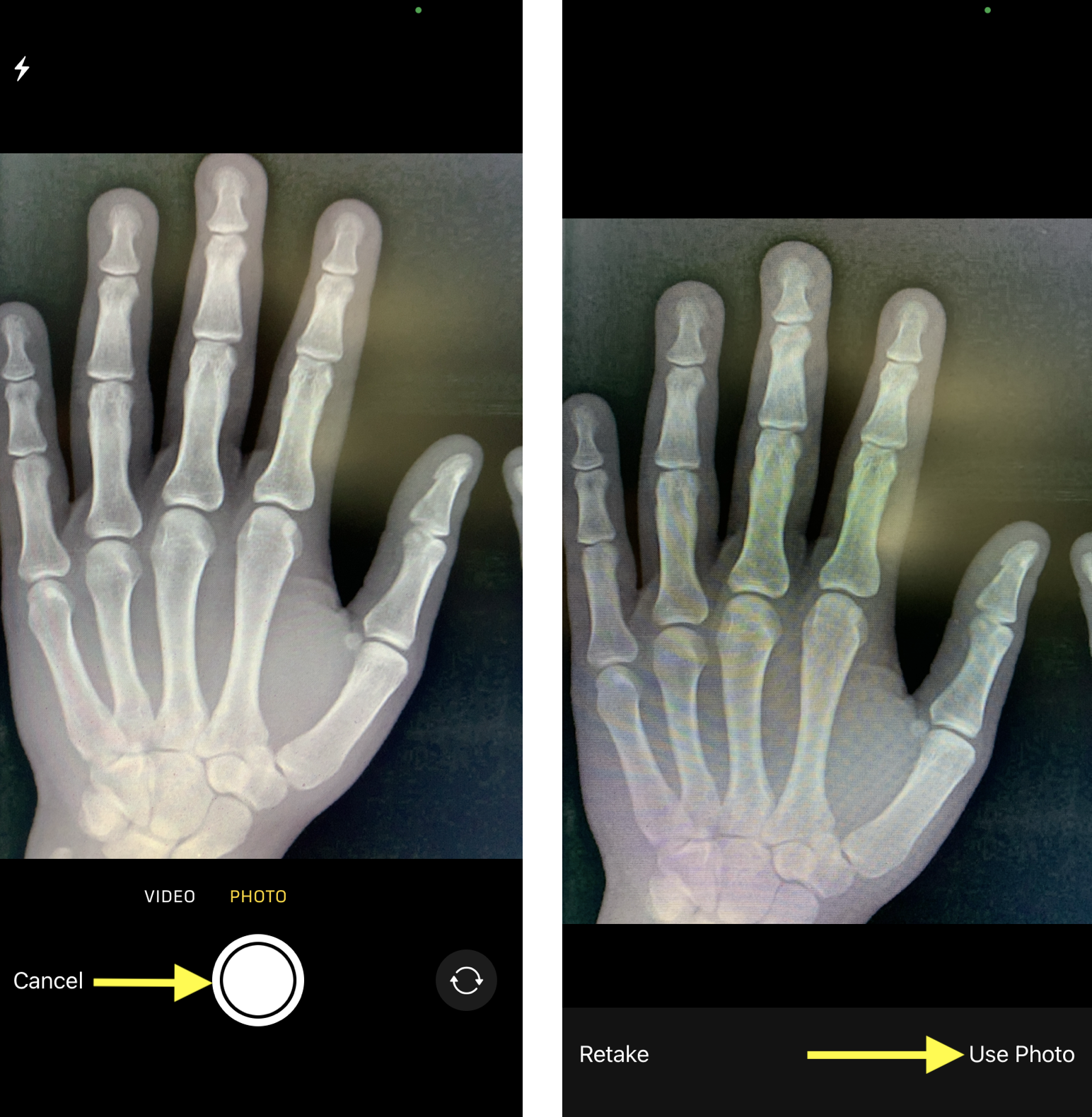 Take_Clinical_Photo_Use_Photo_Side_By_Side.png